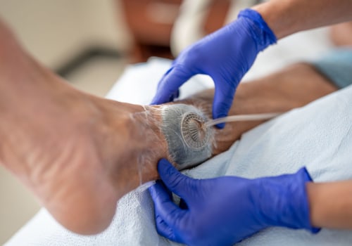 The Benefits of Negative Pressure Wound Therapy