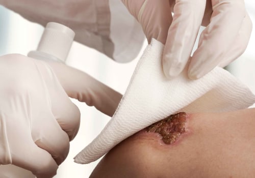 Mastering Wound Vacuum Systems With Granulation Tissue Wound Pictures